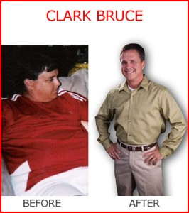 The man with the bionic stomach. And a Fat-to-Fit  success story. Clark Bruce